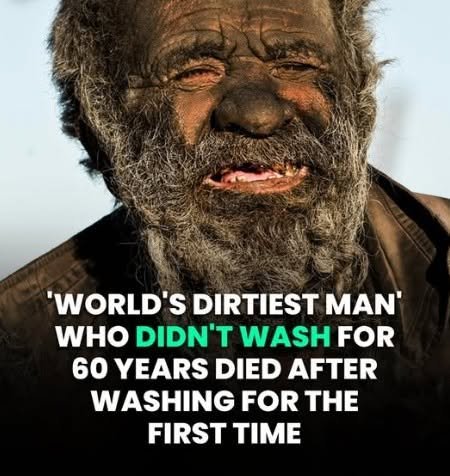 ‘World’s Dirtiest Man…
