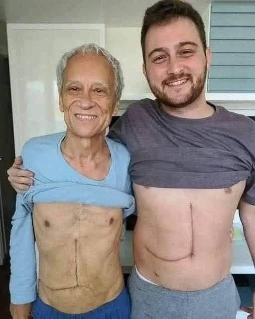Son who donated part of his liver to his father unfortunately ends up fa…See more